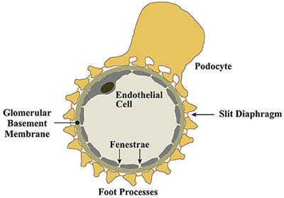 Mechanisms of Proteinuria in HIV